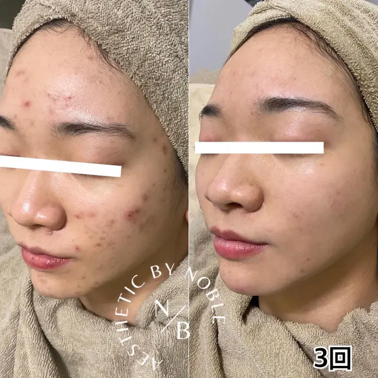 解決策