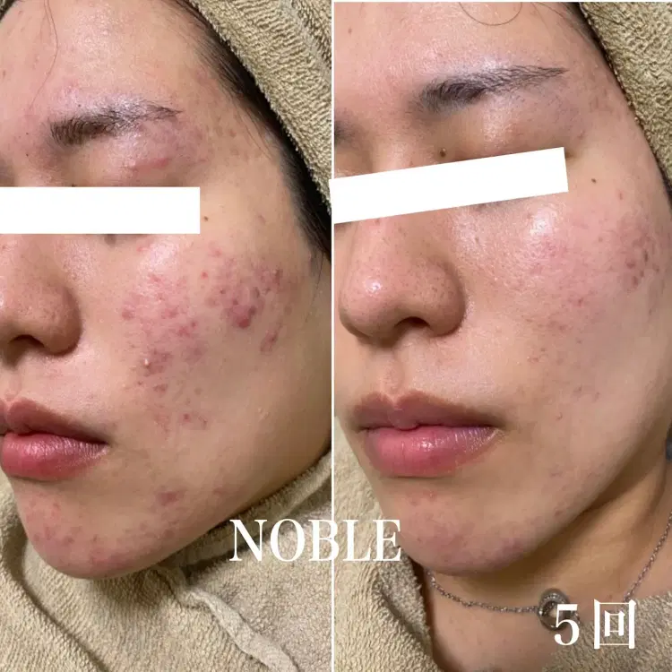 解決策